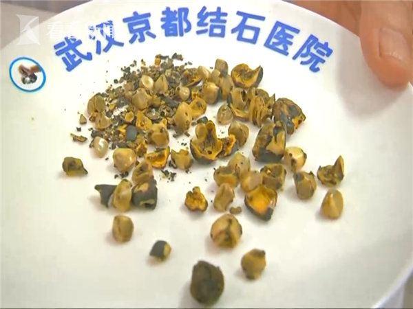 【AG娱乐】秋粮大舞台,今年大豆咋演出?(图1) AG电竞